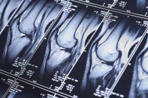 Joints X-ray