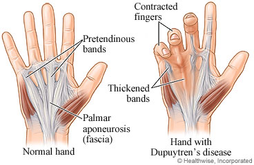 Image of a hand