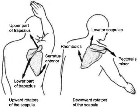 Image of a shoulder pain